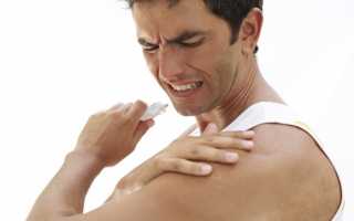Болит плечо при поднятии руки вверх – 9 причин
