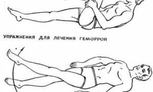 Гимнастика при геморрое: основные упражнения и техника выполнения